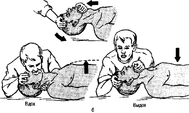 Искусственное дыхание «рот в рот» Искусственное дыхание «рот в рот»