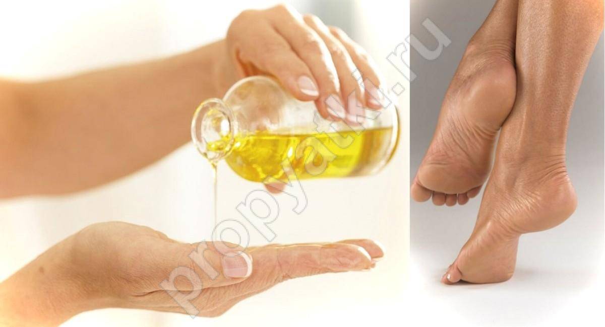 Лечим трещины на пятках, лечение в домашних условиях - быстро