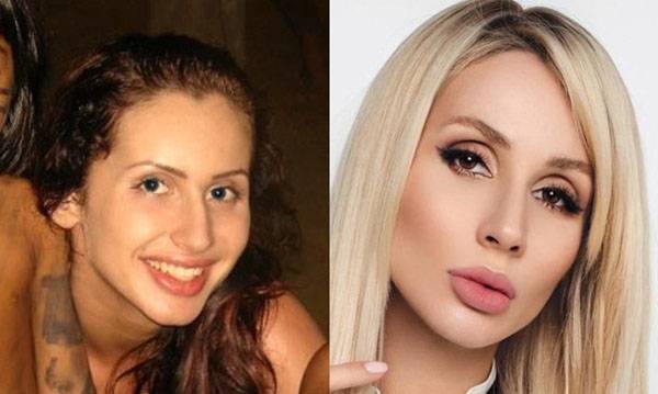 «все натуральное?! ну-ну...» хирурги оценивают российских звезд и определяют, кто из них сделал пластику