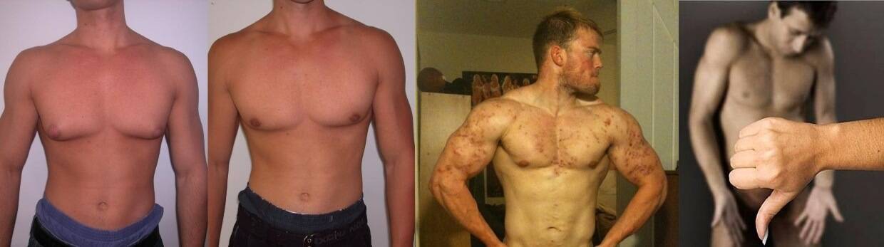 Легальные стероиды в аптеке, список лучших