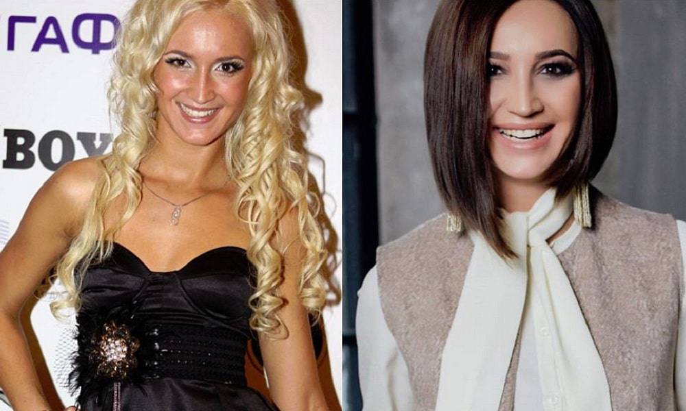 Ольга бузова до и после пластических операций и косметологических процедур +фото