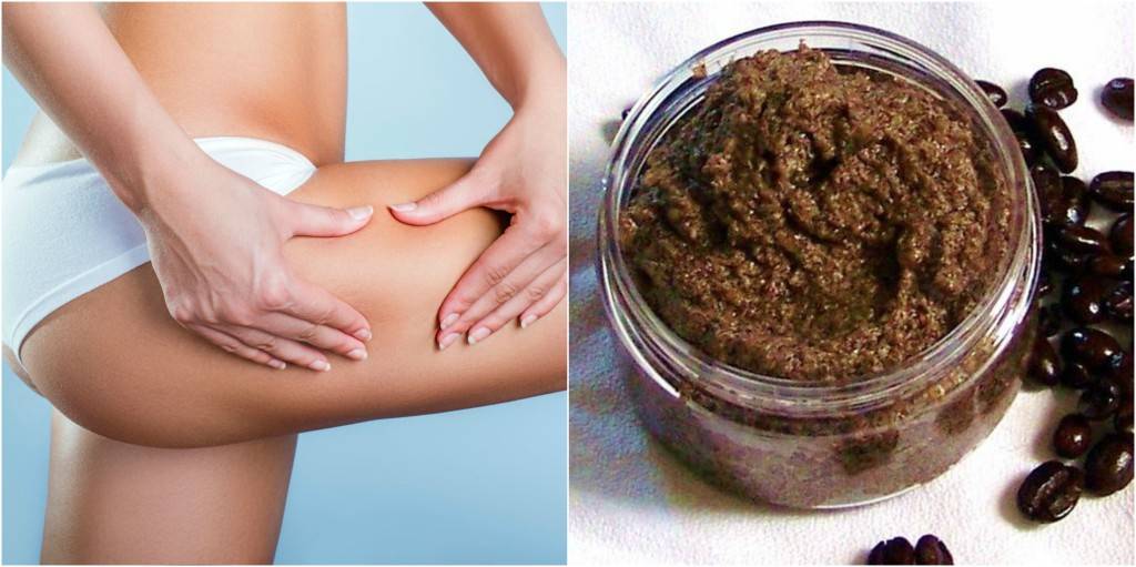 Солевой скраб от целлюлита - рецепты борьбы своими руками