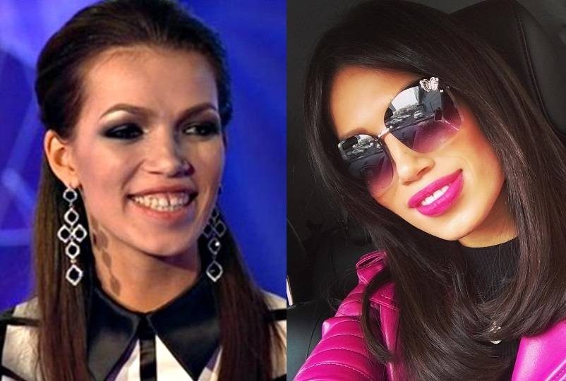 Бузова до и после пластических операций +фото и биография