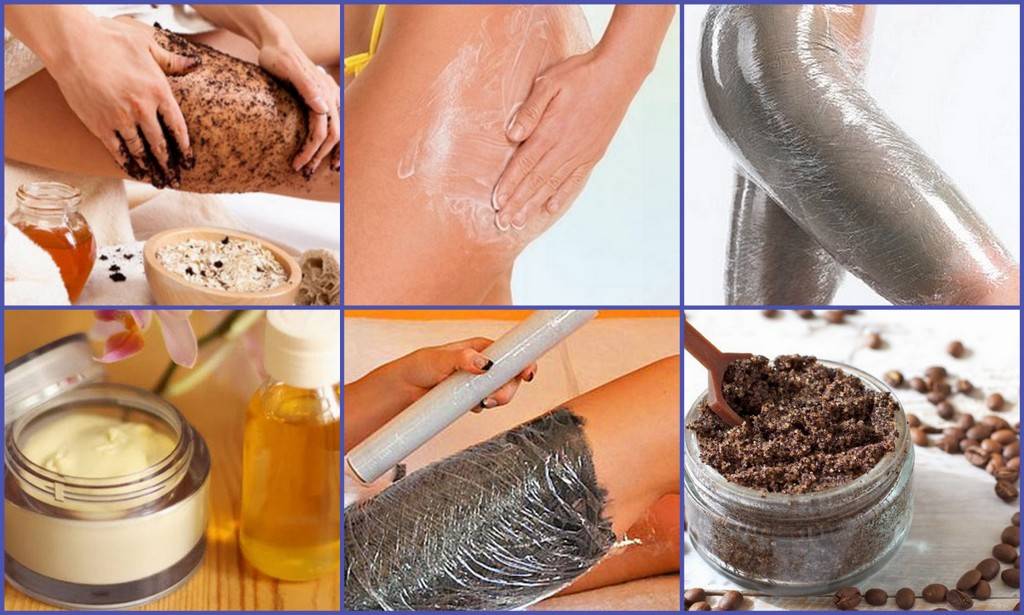 Как убрать большой живот в домашних условиях. виды и причины возникновения большого живота, его вред для здоровья | здоровая жизнь