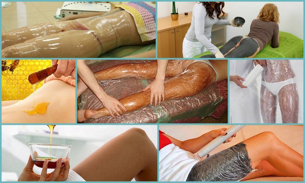 Как убрать обвисший живот в домашних условиях