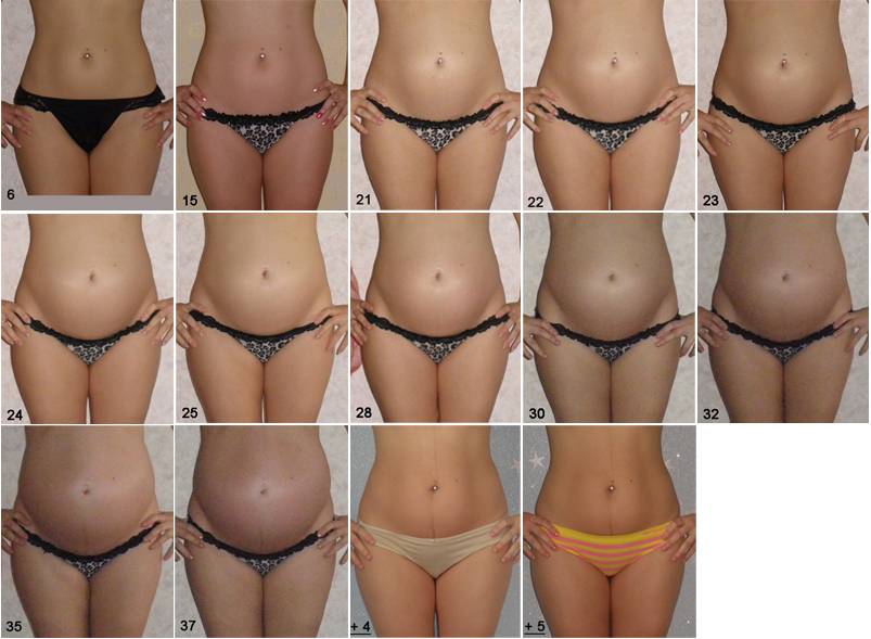 Удаление матки и яичников после 50 лет: последствия и показания к удалению, реабилитация, стоимость на проведение операции в москва