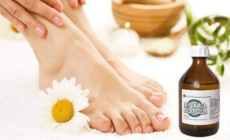 Перекись водорода для пяток в домашних условиях - рецепты лечения