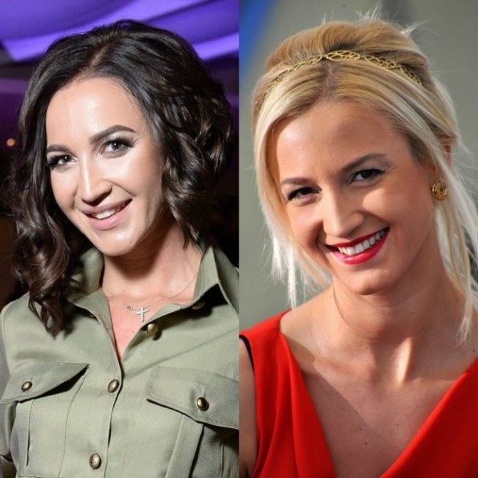 Пластические операции звезд: фото до и после модификаций (2020)