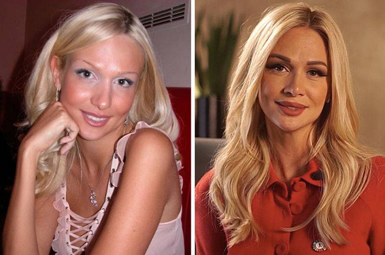 Любовь успенская до и после пластики: фото в молодости и сейчас, какие делала пластические операции, новости и фото 2020