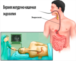 Эндоскопия желудка у взрослого человека