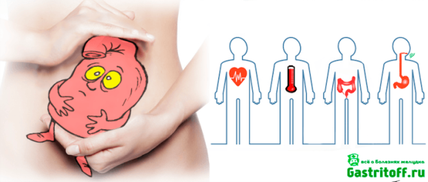 Проявление симптомов катарального гастрита картинка