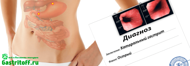 Дигноз - катаральный гастрит